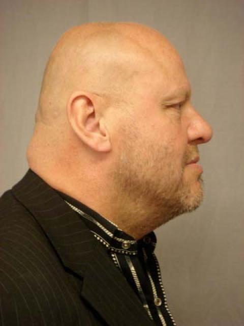 #1802 Steen
